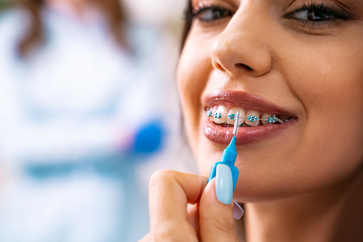 Ortodoncia y salud gingival: cómo mantener una higiene eficaz durante el tratamiento