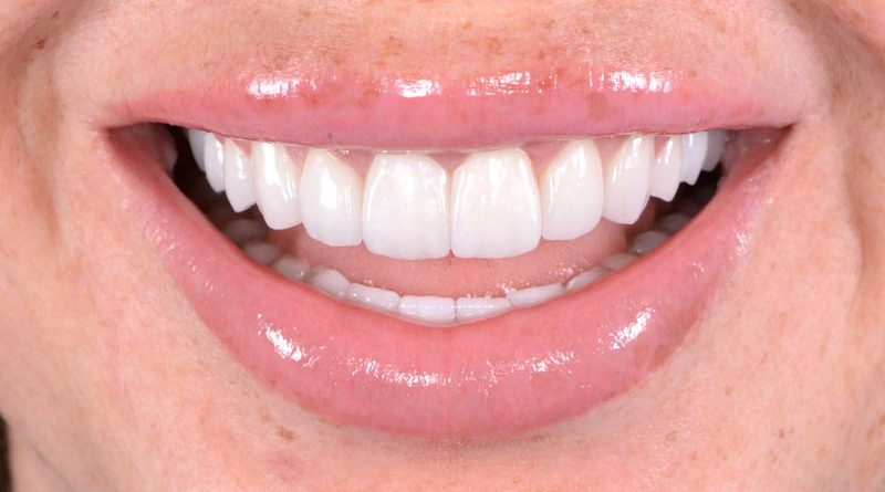 sonrisa-bonita-dentista